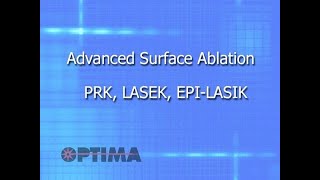 Advanced Surface Ablation – PRK, LASEK, EPI LASIK