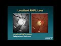 the 5 rs of examining the optic disc malik y. kahook md