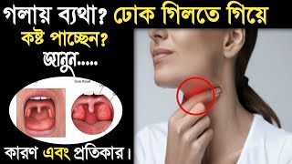 গলা ব্যথা দূর করার উপায়-গলা ব্যথার ঘরোয়া উপায়-What to do if sore throat-Gola betha dur korar upay