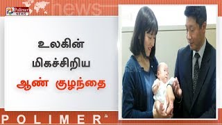 குறைவான எடை கொண்ட உலகின் மிகச் சிறிய ஆண் குழந்தை