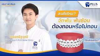 Help Me Plus Ep 3 | จัดฟัน ฟันซ้อน ต้องถอนหรือไม่ถอน