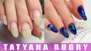 Зимний Маникюр/ МЯСИСТЫЙ Птеригий/ Коррекция Гель Лаком/ Татьяна Бугрий