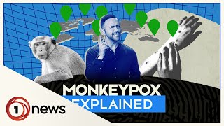 Monkeypox: Should we be worried?