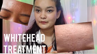 White head cause and treatment in nepali ❤️🇳🇵