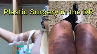 The Ugly Side Of Plastic Surgery | What They Dont Tell You | Gina Jyneen