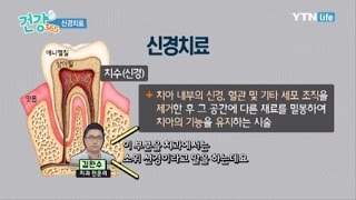 신경치료란? / YTN 라이프