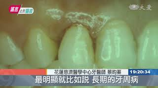 拔牙增「失智症」風險？