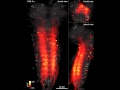 Neural Map of Living Fruit Fly Larva Captured for First Time