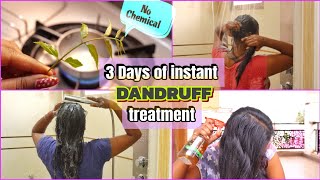 Instant DANDRUFF treatment without any artificial chemical #dandruff  #dandrufffreehair