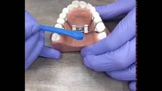 Something's Wrong! Help!: I can't turn my expander anymore because I can't find the hole.