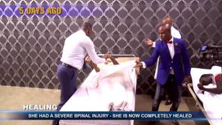 Crooked Spine gets straightened by the power of God at Alleluia Ministries with Pastor Alph Lukau
