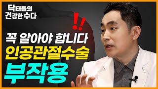 인공관절 부작용 | 수술 부작용을 줄이는 방법은? | 무수혈 인공관절 수술 【닥터들의 건강한 수다 - EP.01】