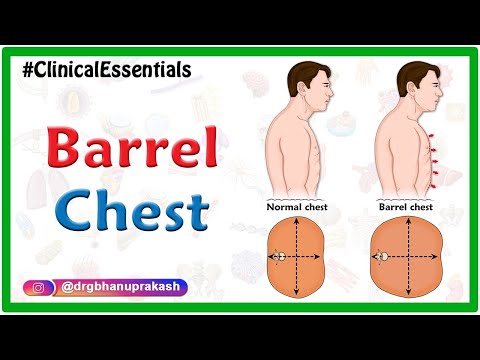 Can you fix being barrel chested?