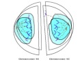 anaphase lag easy explanation