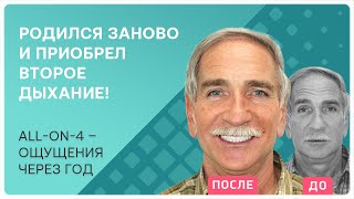 Все зубы all-on-4 👉 отзыв пациента через год после имплантации