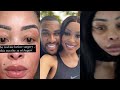 Khanyi Mbau explains why she did the horrible surgery to her face||Pics inside