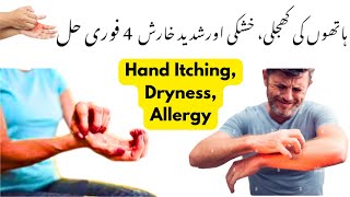 Hathon mein kharish hona - Hatho me khujli ka ilaj - Itching on hands home remedies - ہاتھوں کی خارش