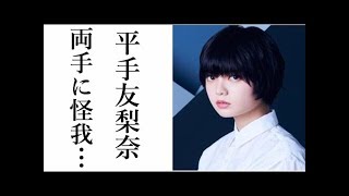 【欅坂46】平手友梨奈両手に怪我…