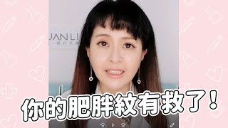 你以為沒救了的肥胖紋、妊娠紋其實通通可以靠這些來治療！#shorts