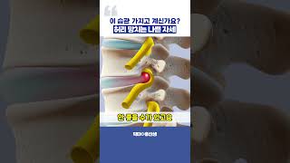 허리 망치는 최악의 습관은?  허리 건강에 안 좋은 나쁜 자세들! #허리통증 #허리디스크 #자세교정