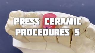 【DENTAL】⑤Press Ceramics  Procedures by Dental Technician RYOSUKE SHIMIZU. 松風のプライムプレスの歯科技工手順