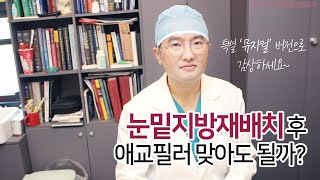 [부산서면성형외과]뮤지컬 Ver. 눈밑지방재배치 후, 애교필러를 맞아도 될까요?(*)