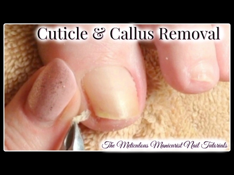 Pedicure Tutorial: Cleaning Toenail Buildup and Cuticle Removal Pedicure Tutorial: Cleaning Toenail Buildup and Cuticle Removal