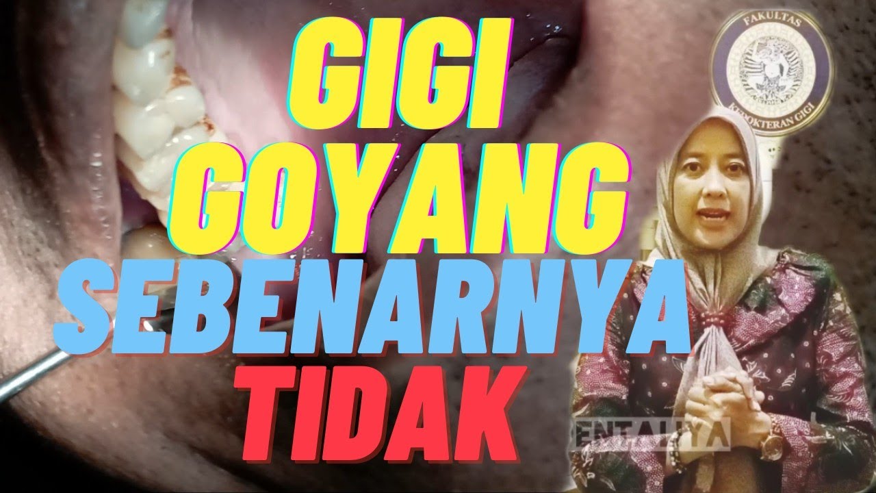 GIGI GOYANG SEBENARNYA TIDAK... JANGAN BURU-BURU DICABUT - YouTube