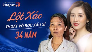 Màn Lột Xác ngoạn mục của cô gái 34 tuổi | Gọi 19006466