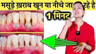 कितने भी मसूड़े ख़राब, खून या नीचे जा रहे है 1 मिनट ये कर लो |  Bleeding Gums