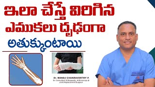 విరిగిన ఎముక అతుక్కోవాలంటే || Bone Fracture Recovery Tips || Broken Bone Conservative Therapy