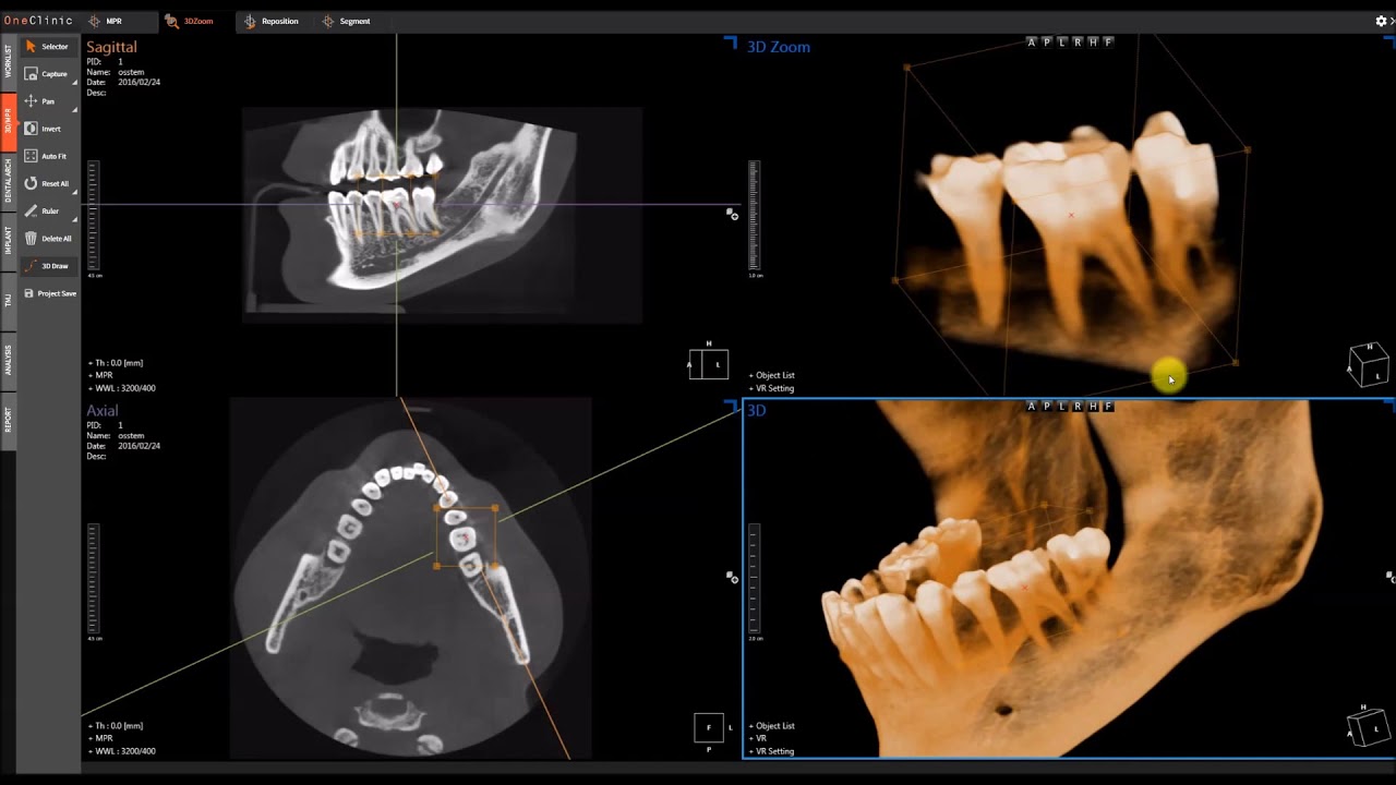 Oneclinic 3d Product Introduction Youtube