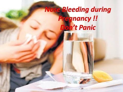 Why nose bleed occurs during Pregnancy? How to treat nose bleed? Why nose bleed occurs during Pregnancy? How to treat nose bleed?