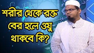 শরীর থেকে রক্ত বের হলে ওযু থাকবে কি?