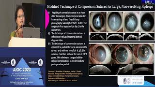 AIOC2023   IC127   topic Dr  M  VANATHI Emergencies associated with advanced corneal ectasias