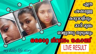 ബെറ്റുണ്ടോ 😱ഒറ്റ ദിവസത്തിൽ ശരീരത്തുള്ള കറുപ്പ് റിമൂവ് ചെയ്യാം / live result / my daily life story