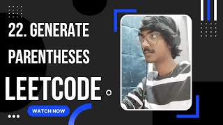 22. Generate Parentheses- leetcode | by Aravind in JAVA