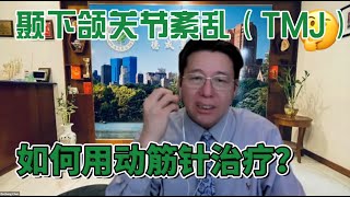 陈德成：颞下颌关节紊乱（TMJ），如何用动筋针治疗？