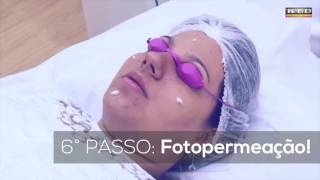 Protocolo de rejuvenescimento: Dermlaser e Endophoton