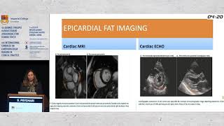 S. Psychari  | Role of epicardial adipose tissue in paroxysmal and permanent atrial fibrillation