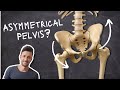 How to Self-Diagnose & Correct Your Own Pelvic Asymmetry (Hidden Cause Revealed!)