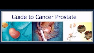 Slideshow: A Visual Guide to Prostate Cancer