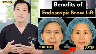 Endoscopic Brow Lift: Everything You Need to Know | Wave Plastic Surgery