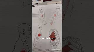 Fix Your Rib Pain with This Simple Stretch