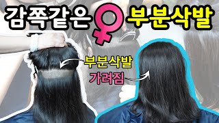 [비절개모발이식]모발이식 감쪽같은 여성 긴머리 부분삭발\u0026마취 리얼 후기 현장 리포트