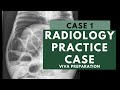 Radiology Viva Practice Case: 1 - FRCR 2B preparation