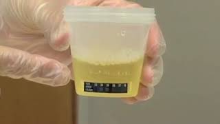 Mackay Drug Testing Services ProScreen Cup