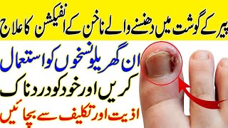 Angutha pakne ka ilaj | nail infection treatment at home | anguthe ke nakhun main drd | resha |