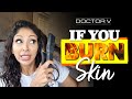 Doctor V - If You Burn Your Skin | Skin Of Colour | Brown Or Black Skin