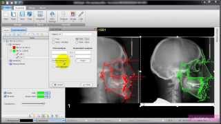 AudaxCeph - Manual Superimposition